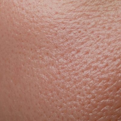 Fagron-FAD_combination_skin