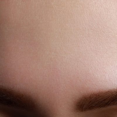 Fagron-FAD_normal_skin