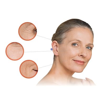 Fagron_Advanced Derma_Aging_Zeichen Hautalterung