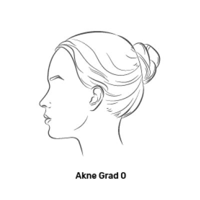 Fagron_Advanced Derma_Akne_Grad 0