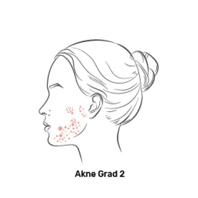 Fagron_Advanced Derma_Akne_Grad 2