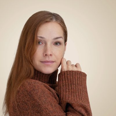 Fagron_Advanced Derma_Hyperpigmentation_Junge Frau